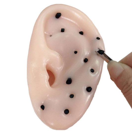 Acne Squeeze Toy, Stress Relief Gadget, Unique Decompression Toy - available at Sparq Mart